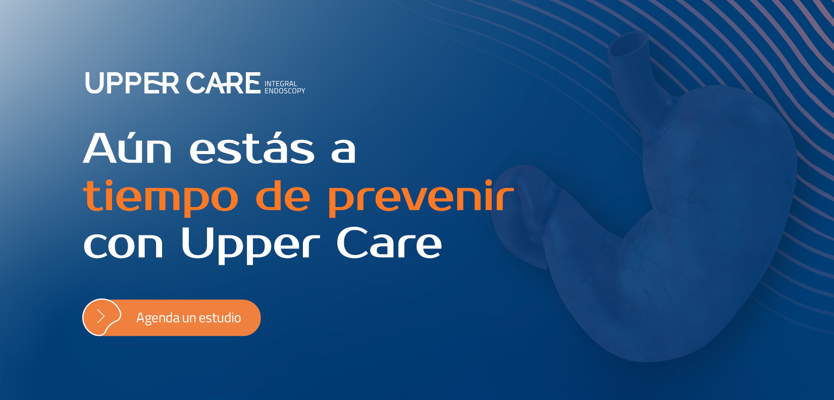 Upper Care Integral Endoscopy Ligadura de Hemorroides un método